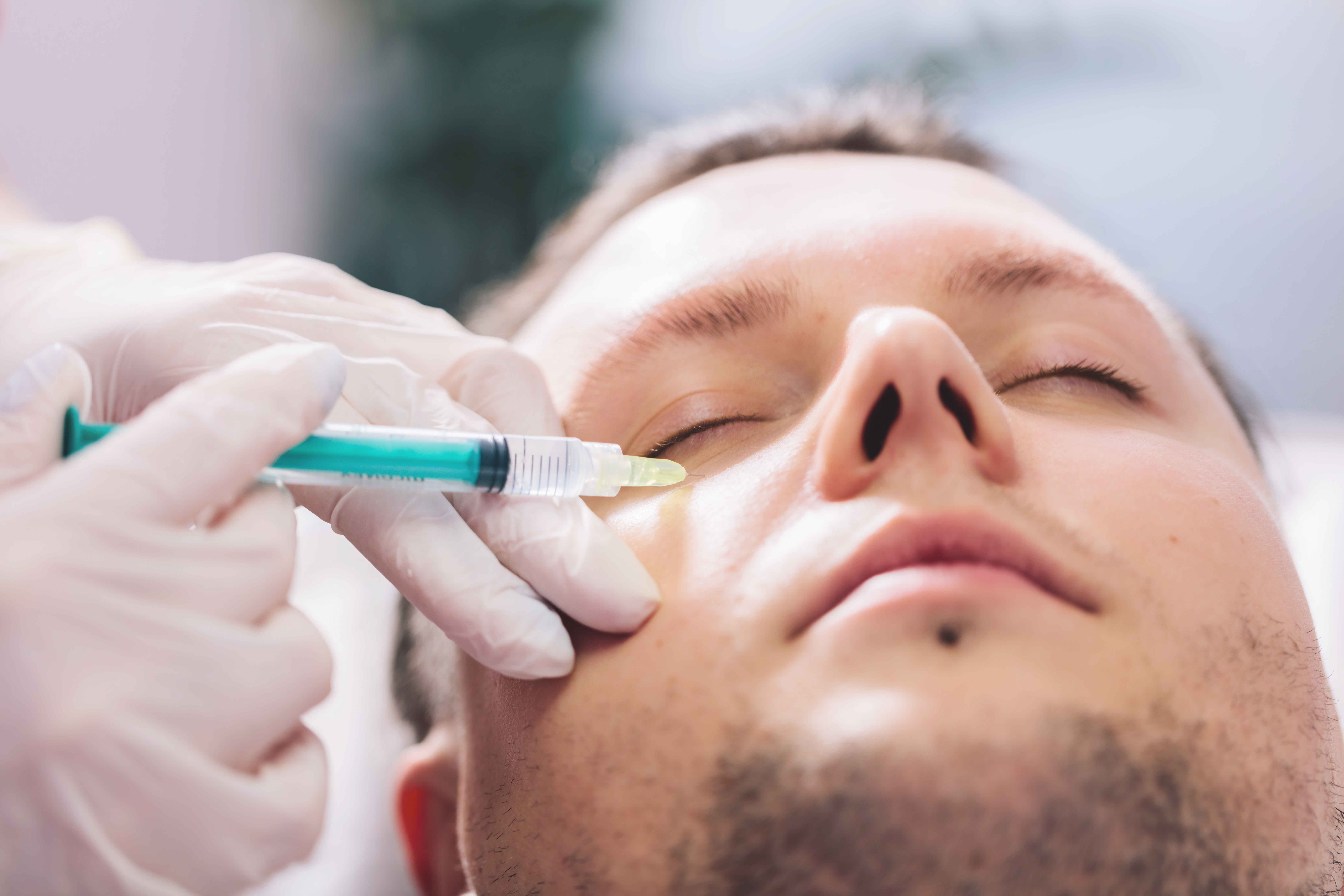 Young Man Getting Vampire Facelift Treatment | Reclaim Men's Clinic in St. Louis, MO